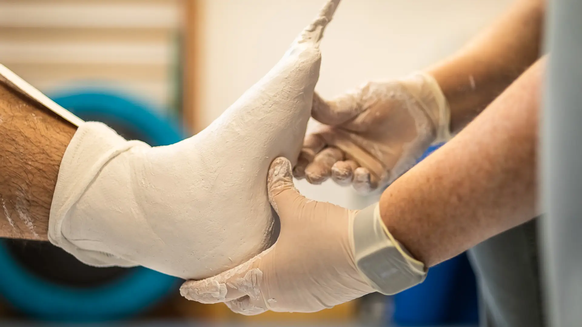 Auf dem Bild ist ein Fuss mit Gips zu sehen, der von den Händen eines Arztes gehalten und untersucht wird.