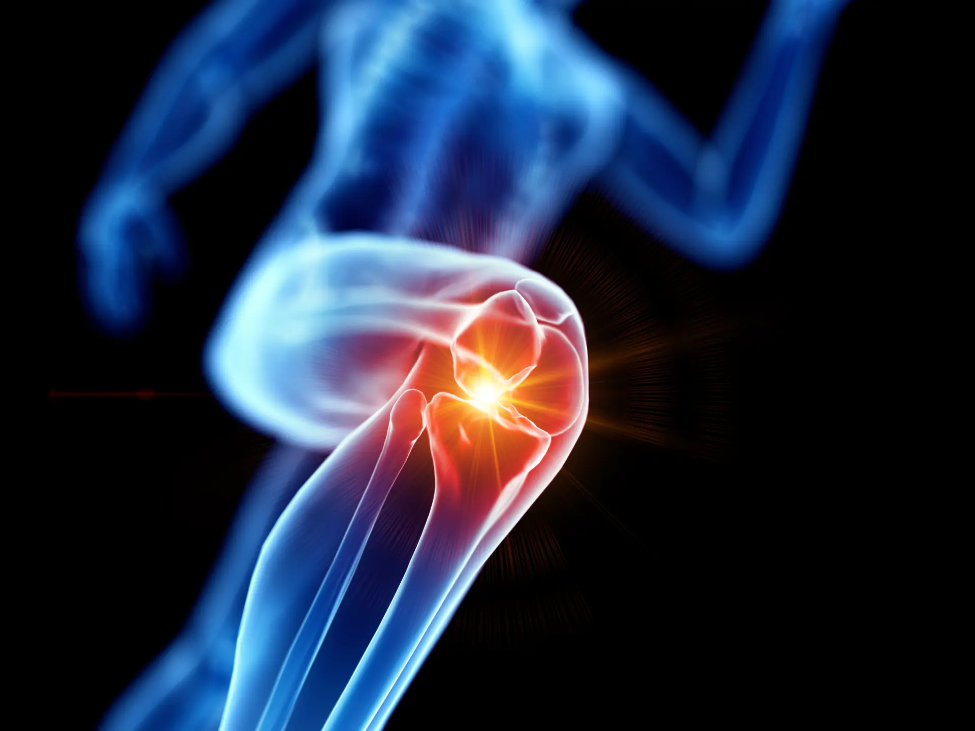 Eine grafische Datei mit einem schmerzenden Knie
